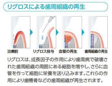 リグロスの作用機序